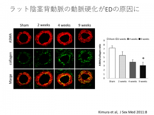 Erectile Dysfunction 読み方 Erectile Dysfunction の部分一致の例文検索結果